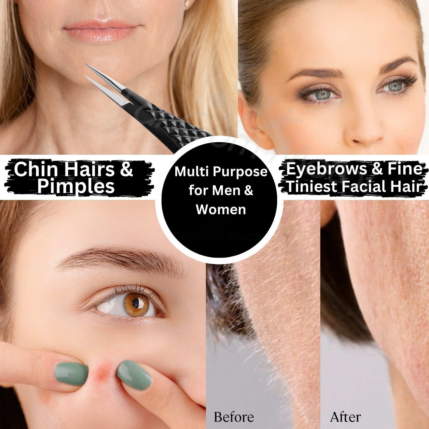 Extra Sharp Tweezers Ingrown Hair Men for Facial, Chin Hair Splinter - Image 3