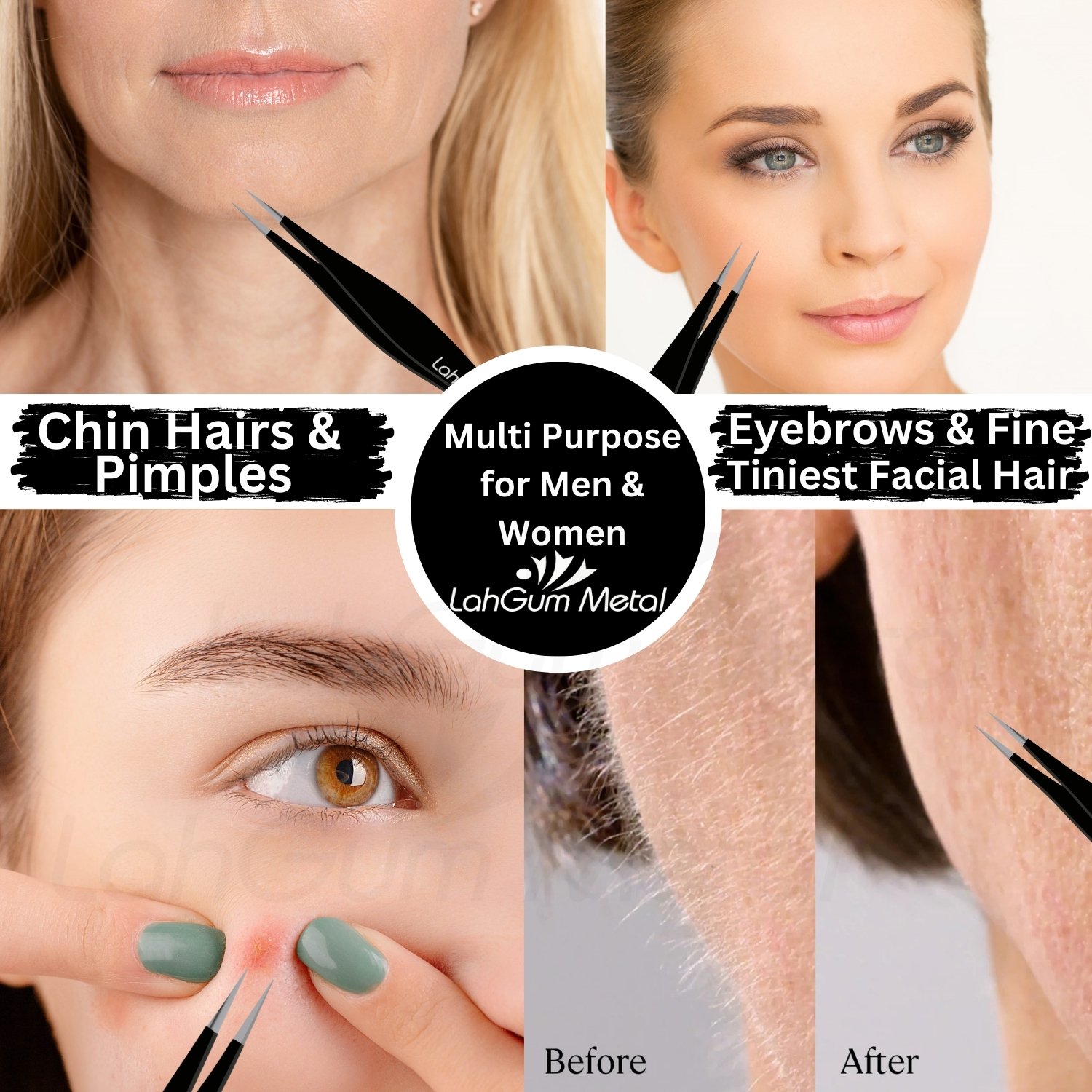 sharp pointy tweezers for ingrown hair removal facial chin splinter - Image 4
